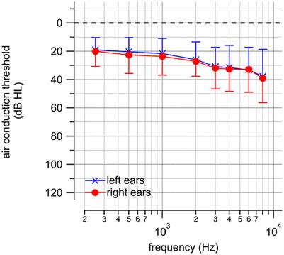Over the counter hearing aids self-fitting using the Gaussian Process Classification